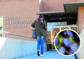 Centro de investigación del Cáncer de Salamanca y detalle de grupo de células tumorales pulmonares con aumento de KRAS para superar la barrera natural Capicua.