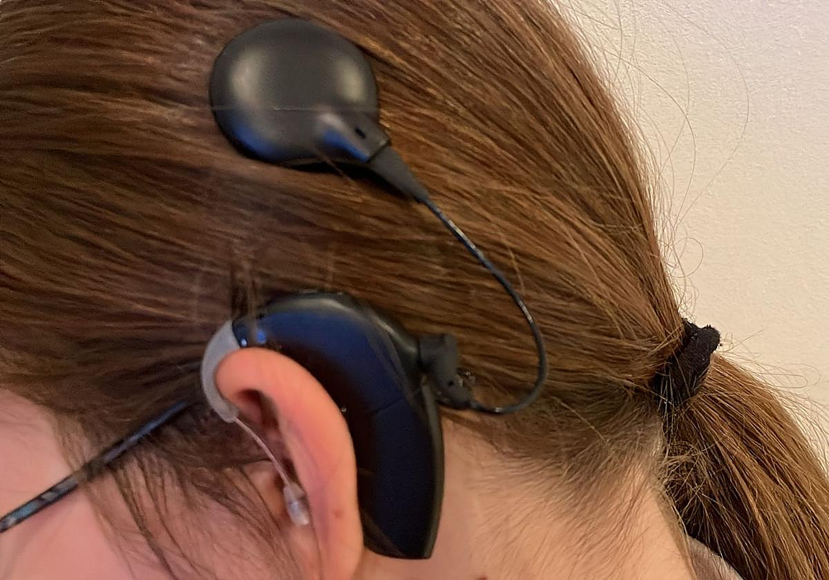 ¿Qué pasó con el implante coclear que perdió Julia?: La familia de la niña pide ayuda al hospital