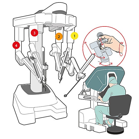 Así funciona el robot Da Vinci Xi del Clínico de Valladolid