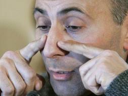 El profesor Laurent Lantieri, encargado de uno de los equipos que han realizado el transplante. /Reuters