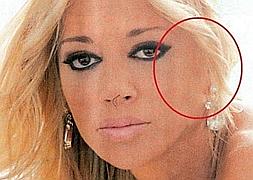 Belén Esteban, en Interviú, desnuda y sin oreja