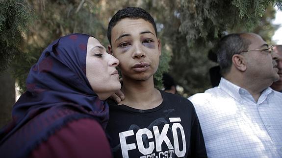Policías israelíes linchan a un primo del palestino quemado vivo