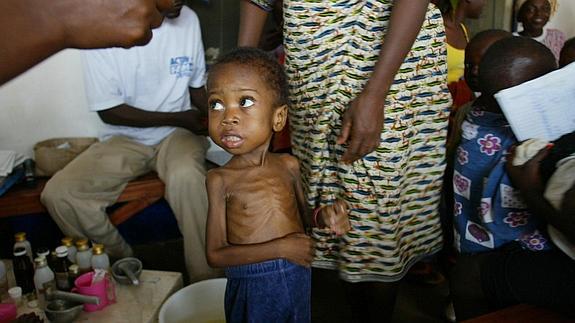 Niño liberiano malnutrido es atendido en la sede de una ONG en Monrovia. 