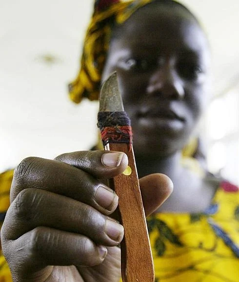 Una mujer de Costa de Marfil sujeta una herramienta antes de realizar una ablación. 