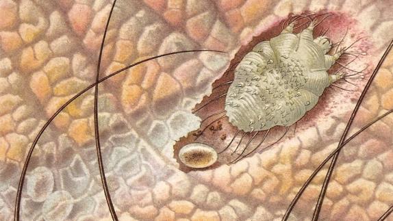 Ilustración del parásito de la sarna