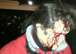 Uno de los heridos, Luis Enjuto, con la cara ensagrentada tras la carga policial / El Norte