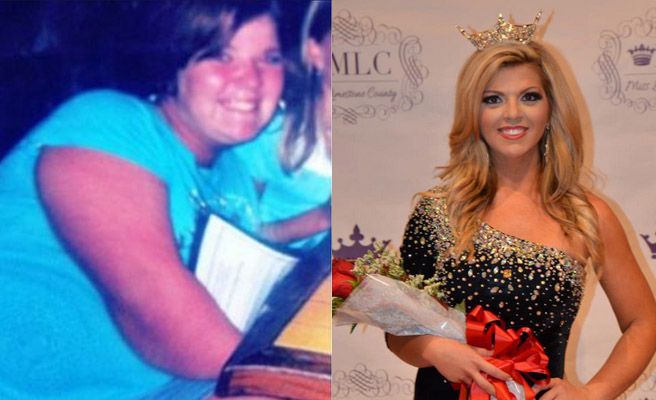 De obesa, a Miss Texas