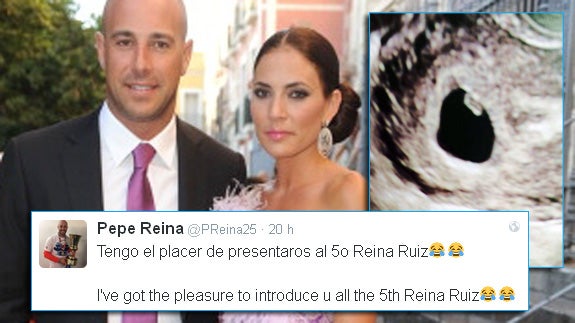 Tuit de Pepe Reina anunciado la noticia, junto con la foto de la ecografía.