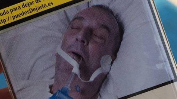 Un gallego denuncia que las cajetillas de tabaco usan una foto suya sin su consemiento