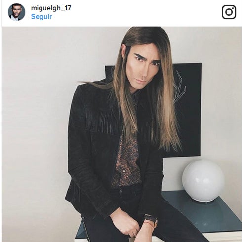 Miguel, de 'GH 17', experimenta un tremendo cambio físico tras pasar por el quirófano