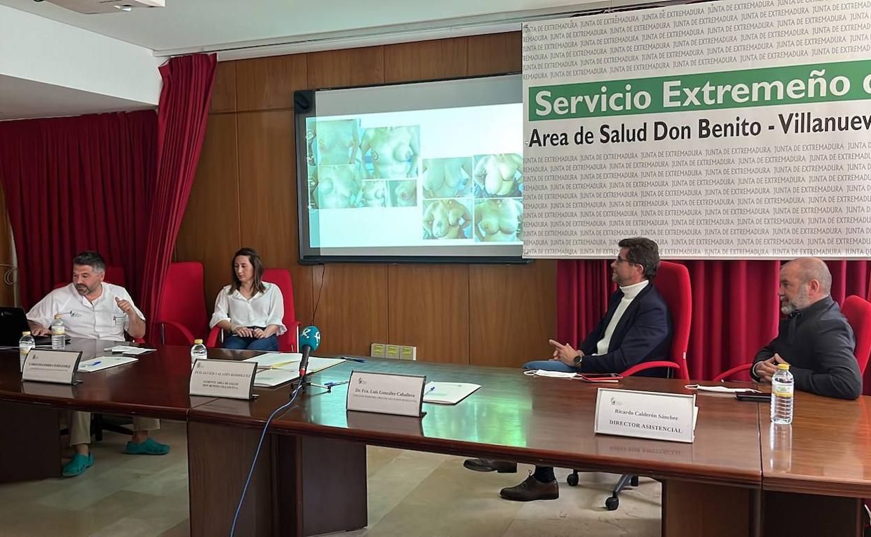 Presentación de la técnica en el hospital comarcal. 
