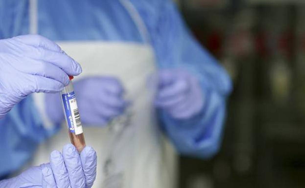 Un sanitario protegido con guantes sostiene un muestra para realizar un Análisis PCR