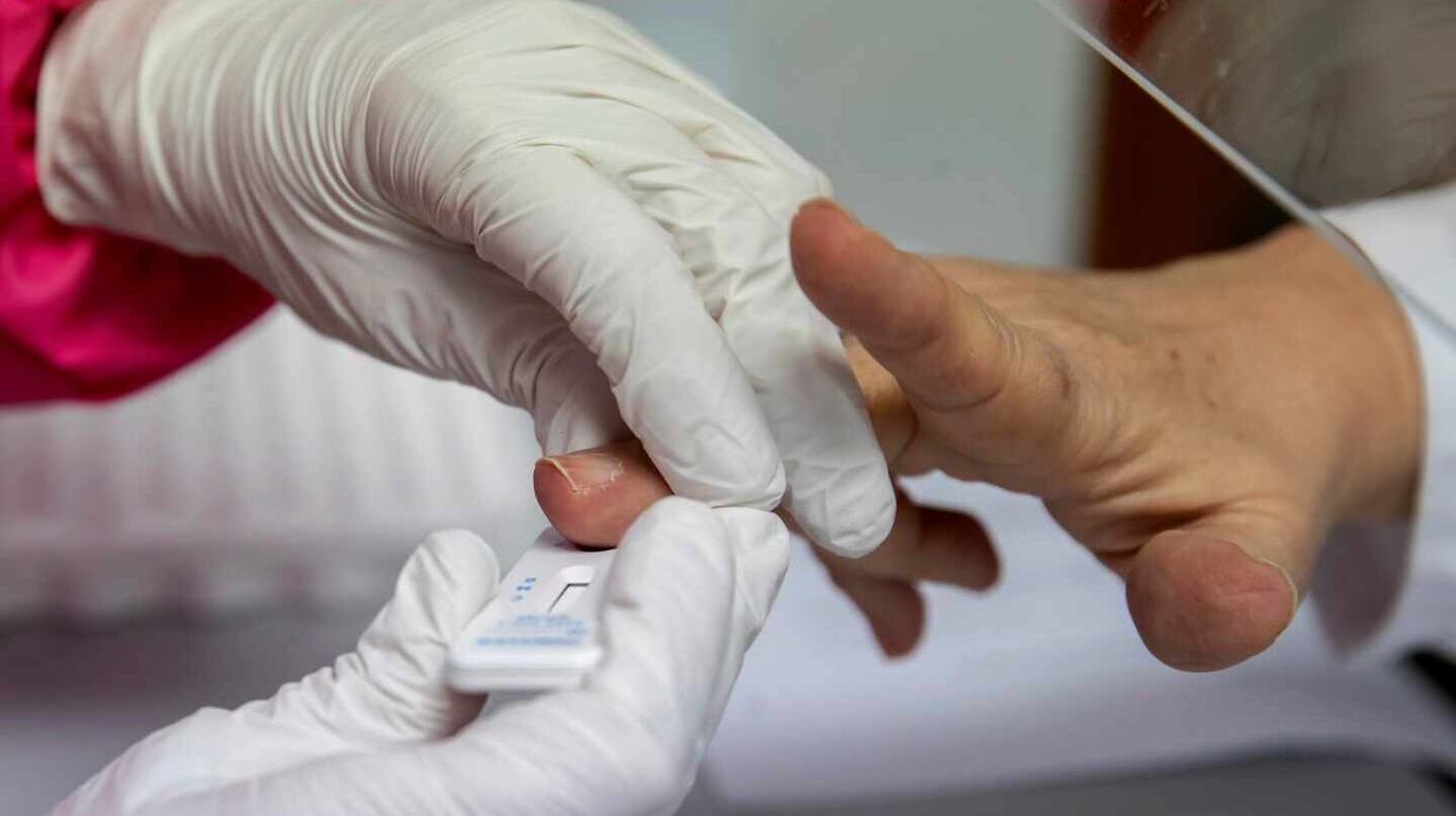 Desde el inicio de la epidemia se realizan diagnósticos mediante PCR 