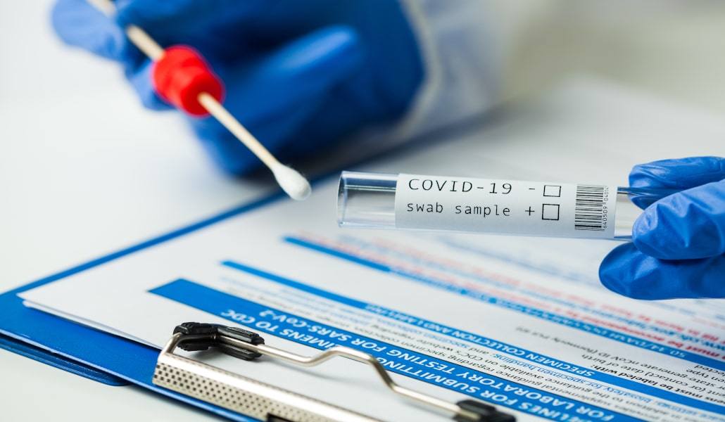 En casos positivos la segunda PCR hay que hacerla tres días después de desaparecer los síntomas 