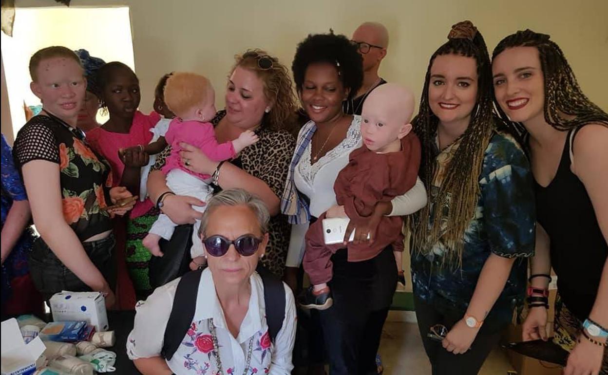 Super África Extremadura cooperará con un centro de albinos de Senegal