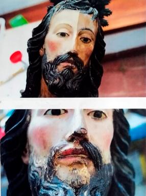 Trabajos realizados en el rostro