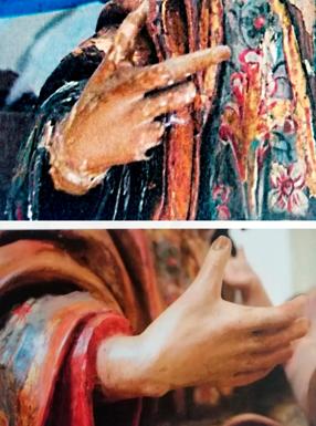 Trabajos realizados en las manos