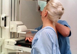 Más de 7.700 extremeñas tienen cita este mes para una mamografía