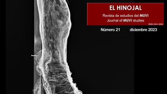 Restauración, emigración y bordados en El Hinojal nº 21