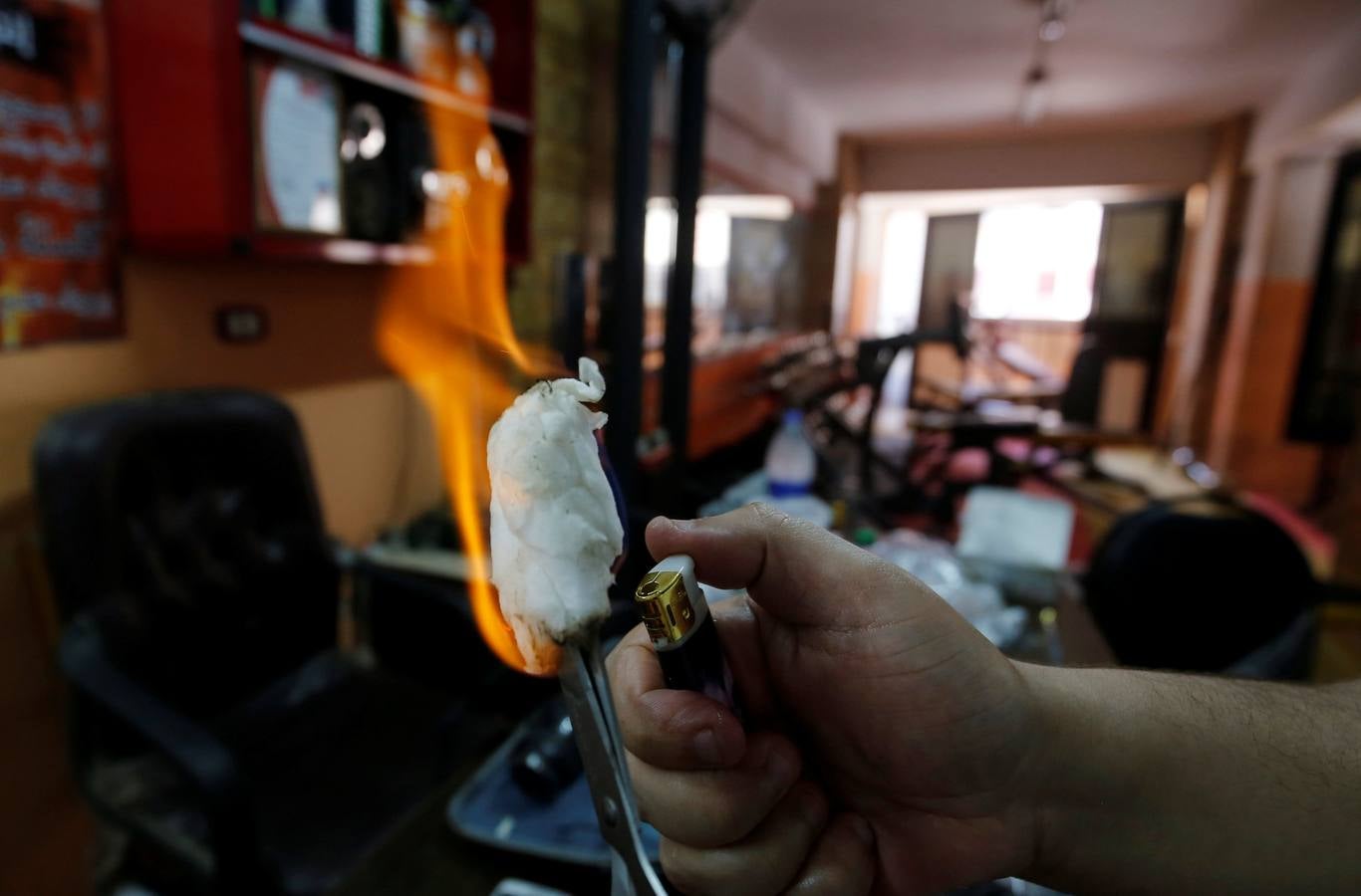 La terapia de ahuecamiento Hijama