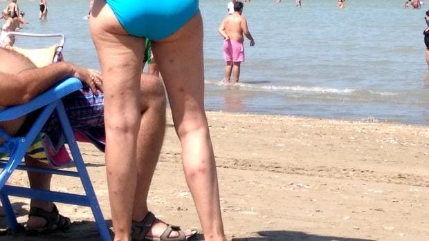 Una mujer con multitud de picaduras en sus piernas, en la playa de Sanlúcar - J. M. B. M.