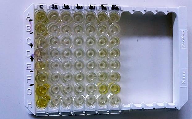 Test de gestación de las linces del centro. 