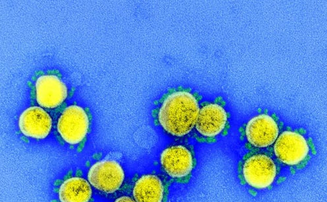 Microfotografía de transmisión de partículas del virus del SARS-CoV-2, aislada de un paciente. Imagen capturada y coloreada en el Centro de Investigación Integrada del NIAID (IRF) en Fort Detrick, Maryland. 