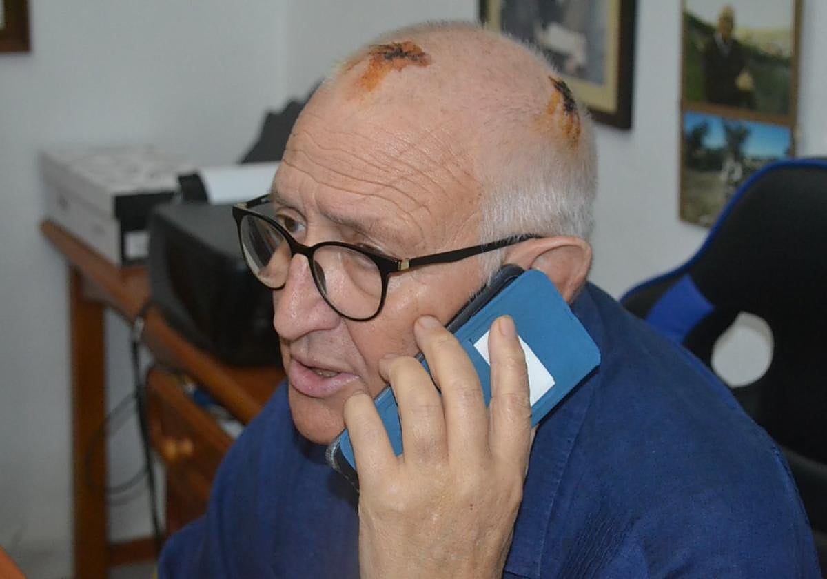 Aún son visibles las herida de la agresión.