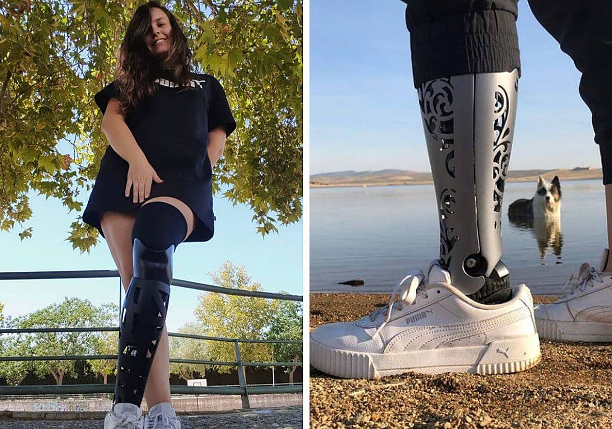 Cristina Magro en fotos posando con sus prótesis.