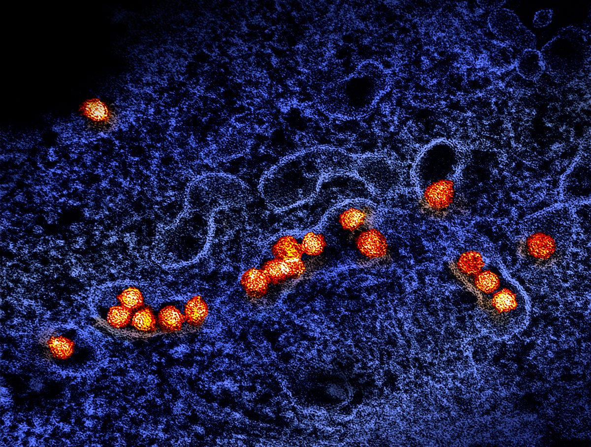 Imagen microscópica de las partículas del virus del Nilo Occidental (manchas naranjas) replicándose en el citoplasma de una célula.