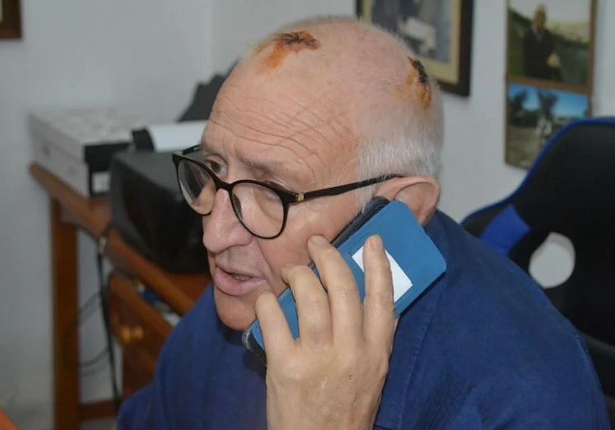 Lucio Poves atiende una llamada días después de recibir el alta médica.