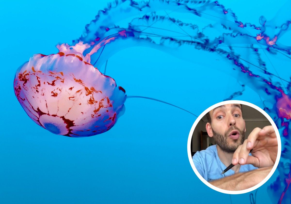 El enfermero Jorge Ángel explica el protocolo ante una picadura de medusa.