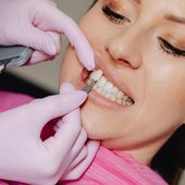 Dentistas alertan: el peligro del auge del 'turismo dental' en Marruecos