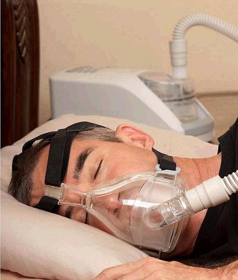 El 30% de los pacientes con apnea del sueño e hipertensión resistente no reducen sus cifras de tensión arterial a pesar de recibir el tratamiento con CPAP. 