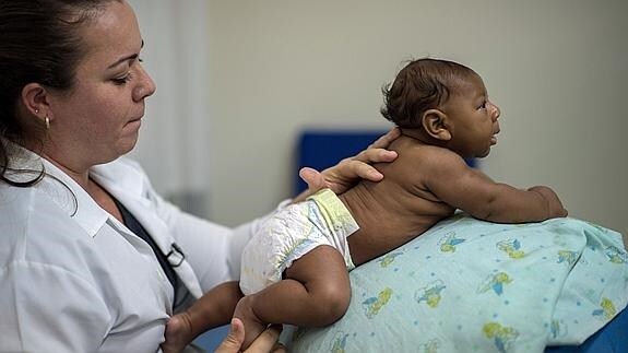 Una pediatra con un bebé con microcefalia en Brasil.