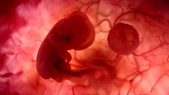 Feto humano en su décima semana de gestación.