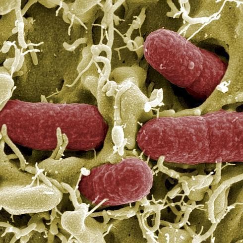 Bacterias de E.coli vistas con microscopio.