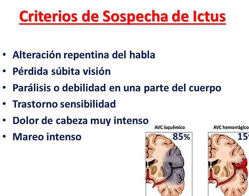 Cómo actuar ante un ictus