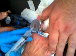 Bomberos del Levante liberan un anillo encajado en el dedo de una anciana