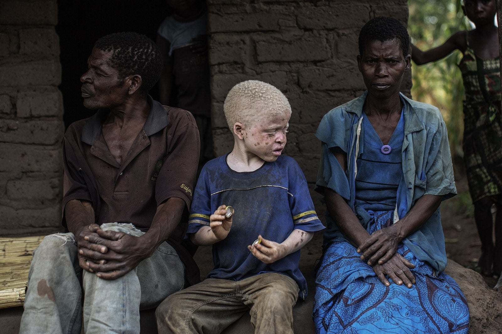Un niño albino entre sus padres en el área de la autoridad tradicional de Nkole, distrito Machinga seis albinos han sido asesinados en la empobrecida nación del sur de África desde diciembre.