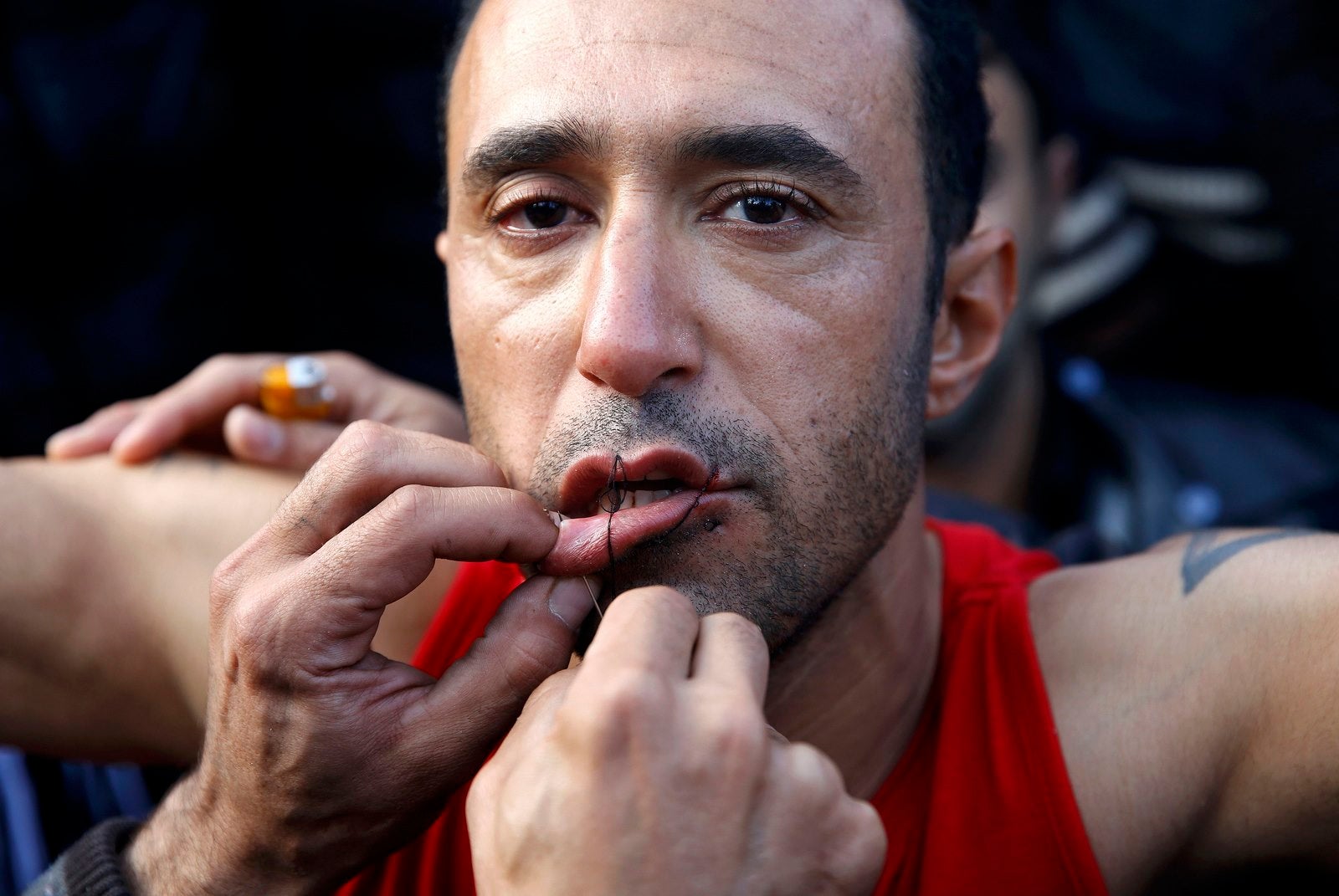 Un inmigrante iraní ha cosido la boca cerrada por un colega durante una protesta en la frontera greco-macedonia cerca de la aldea griega de Idomeni.