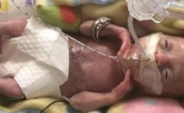 La increíble historia del bebé más prematuro del mundo: nació a las 21 semanas y sobrevivió