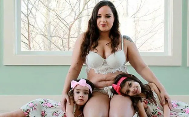 "Debemos mostrarlo con orgullo": reivindica sus estrías tras ser madre