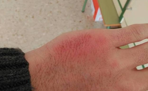 "Soy docente y esta lesión me la ha causado un alumno": la viral denuncia de un profesor andaluz sobre la violencia en las aulas