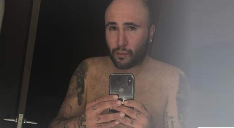 Tras someterse a una operación