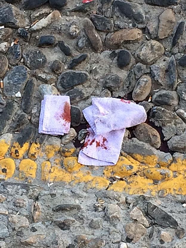 Sangre en el sitio de la caída. 