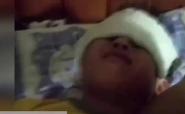 Imagen de un escolar herido por la luz UV de su clase en China.