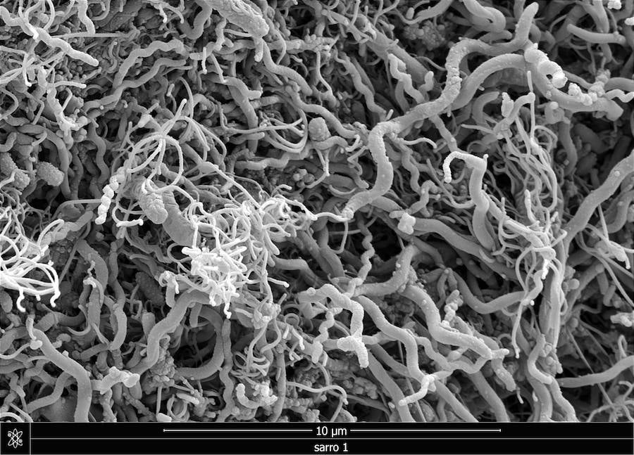 Placa bacteriana del sarro