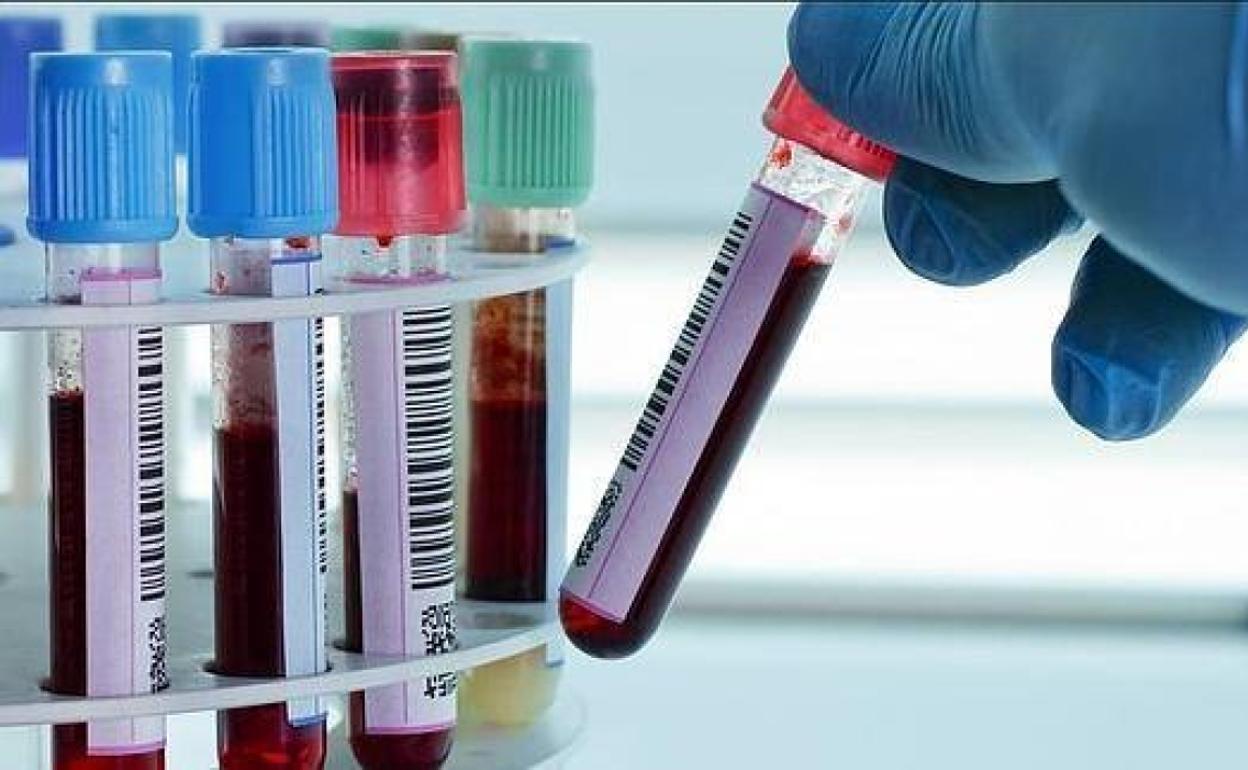 Un análisis de sangre podría predecir la probabilidad de muerte