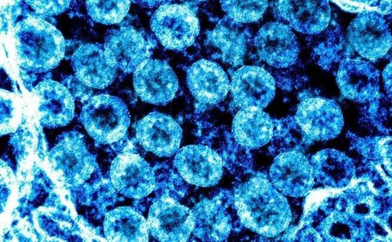 Virus en un microscopio.